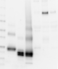 AMBP | Bikunin in the group Human/Animal Antibodies / Human Proteins / Other Human proteins at Agrisera AB (Antibodies for research) (AS04 039)